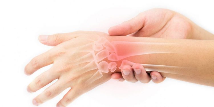 l'osteoartrite del polso o della mano